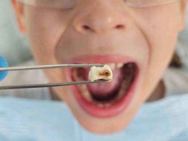 Best Broken Tooth Emergency  in Fruitville, FL